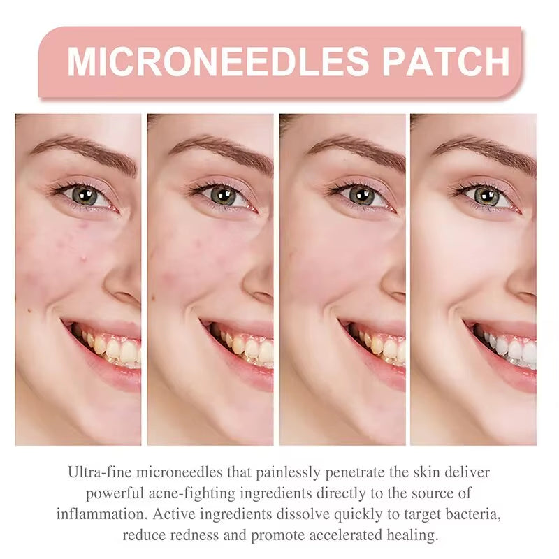 Pimple Patch Invisible Beauty Concealer