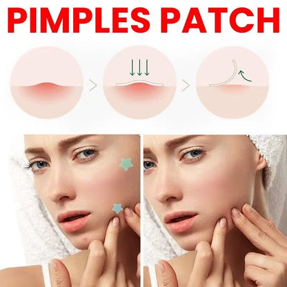 Repair Acne Patch Facial Skin Care